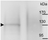 PHOT1 | Phototropin-1 in the group Antibodies Plant/Algal / Plant Developmental Biology / Photomorphogenesis at Agrisera AB (Antibodies for research) (AS10 720)